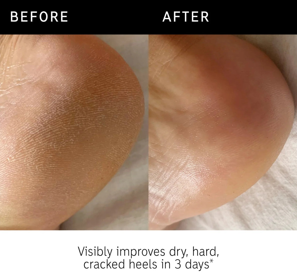 Glycolic Acid Exfoliating Body Stick