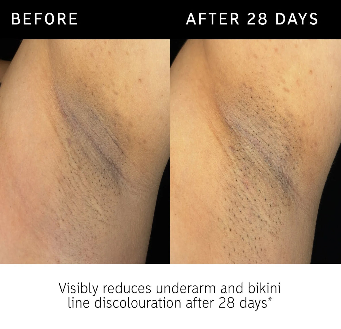 Glycolic Acid Exfoliating Body Stick