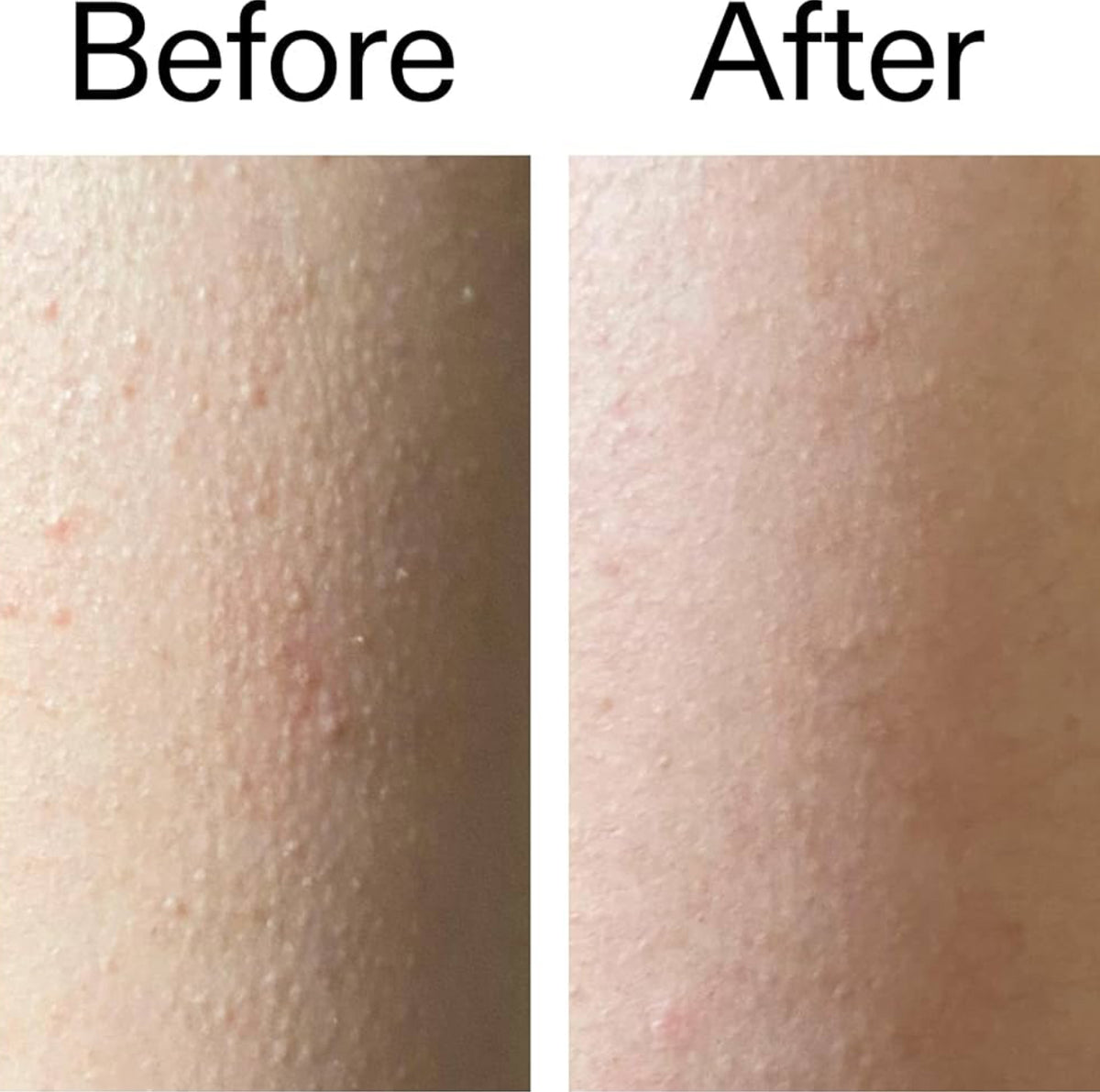 Glycolic Acid Exfoliating Body Stick
