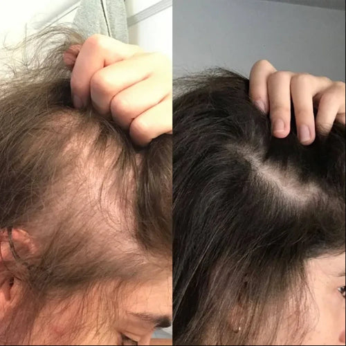 Scalp Moisturizing Essence with Massage Comb